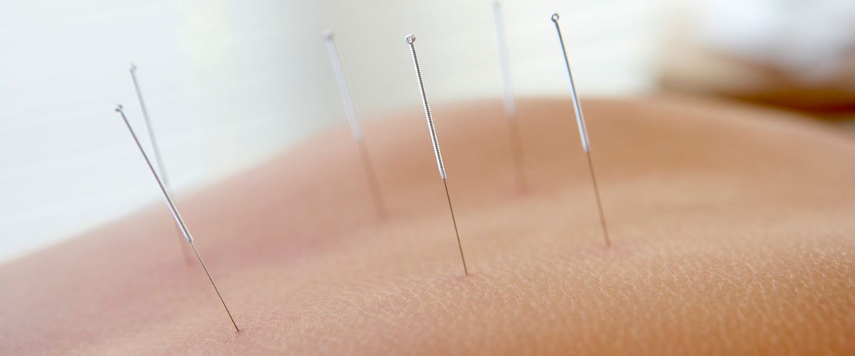 Celebrate Skincare Month with Acupuncture!